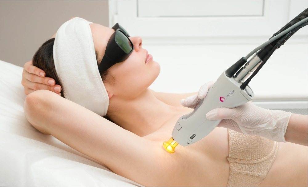a woman getting laser hair removal